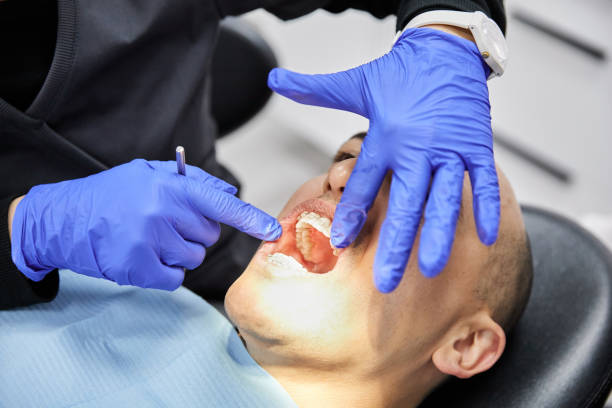Best Knocked-Out Tooth (Avulsed Tooth) Treatment in Hickory Creek, TX